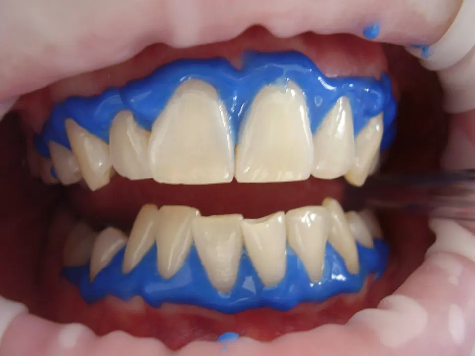 What Can Cosmetic Dentistry Do For Me? Cosmetic Dentistry for You