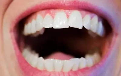 New Year, New Goal: Excellent Oral Hygiene