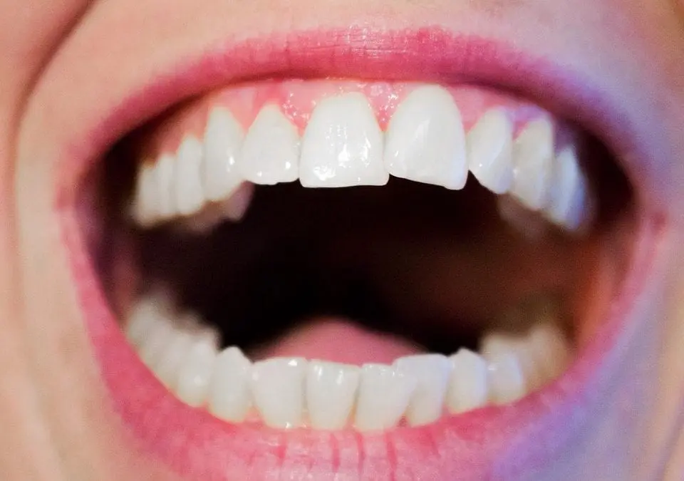 New Year, New Goal: Excellent Oral Hygiene