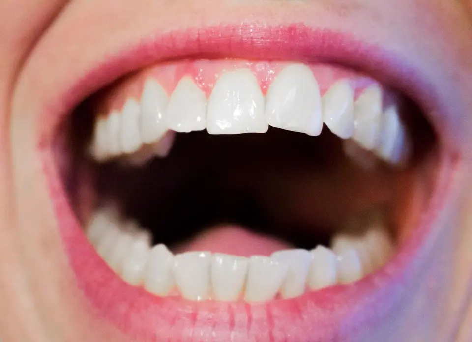 New Year, New Goal: Excellent Oral Hygiene Excellent Oral Hygiene