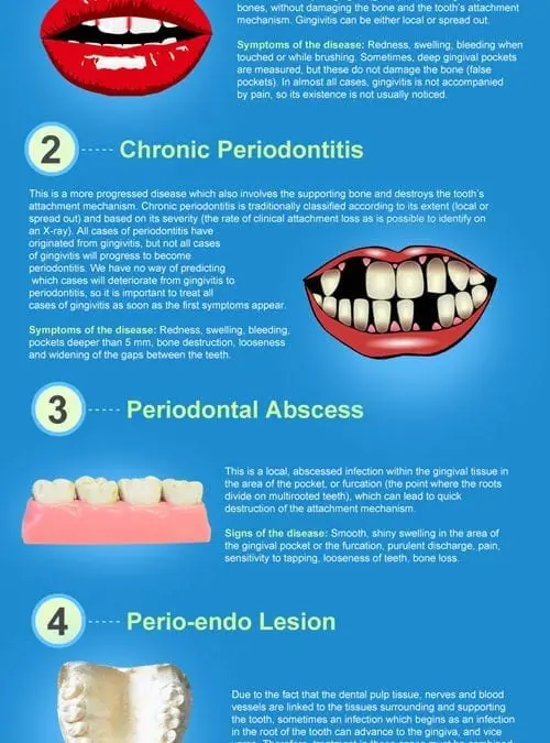 Types of Gum Disease [infographic]