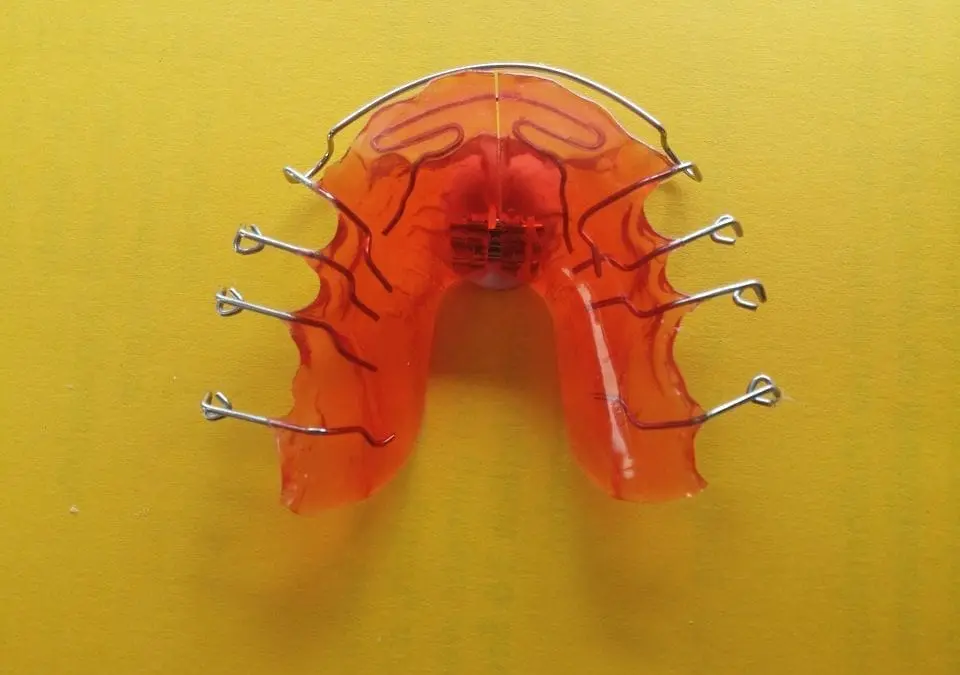 Considering Braces?