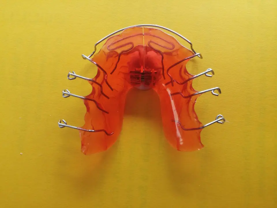 Considering Braces? Consider Braces