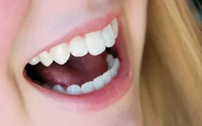 Does Arthritis Affect Oral Care?