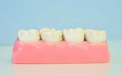 What Is An Abscessed Tooth?