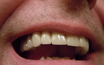 The Importance of Oral Health in Older Adults