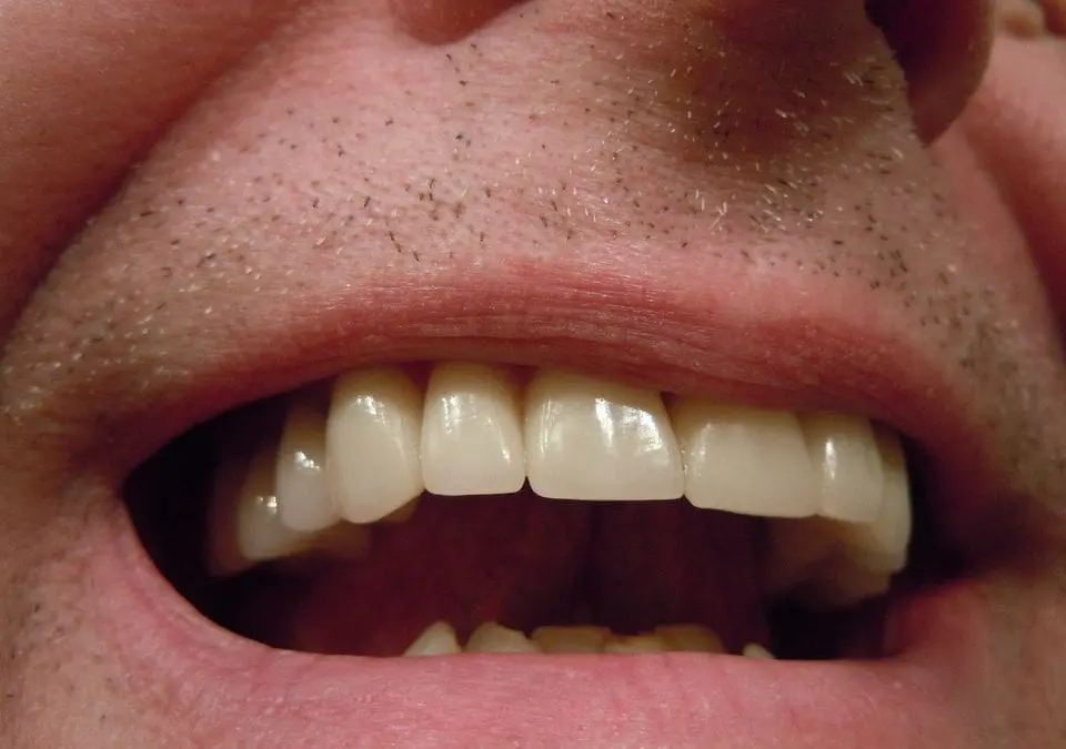The Importance of Oral Health in Older Adults
