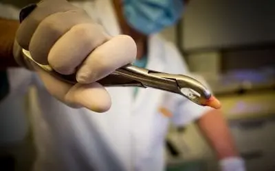 What’s the Purpose of Wisdom Teeth?