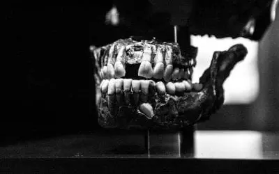 Why Adult Teeth Fall Out