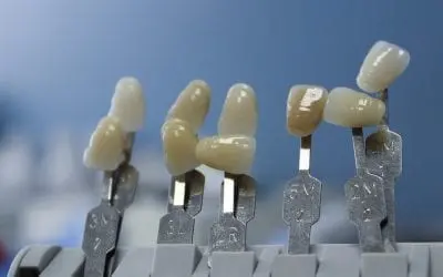 How to Care for Your Dental Ceramics