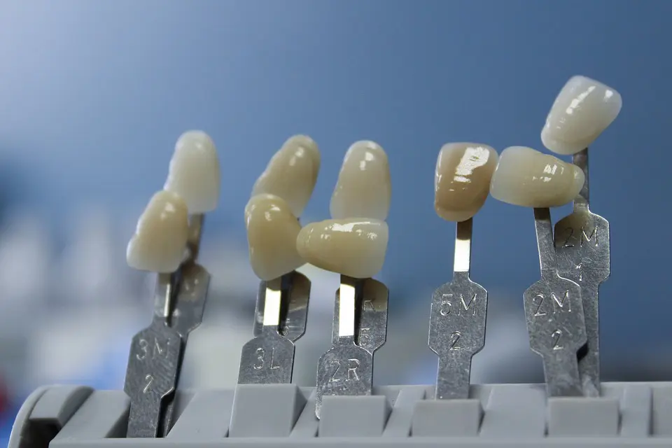 Care for Your Dental Ceramics Care for Your Dental Ceramics