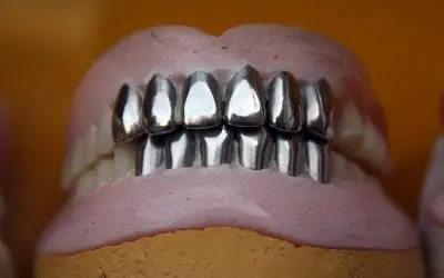 Should You Get a Metal or Tooth-Colored Filling?