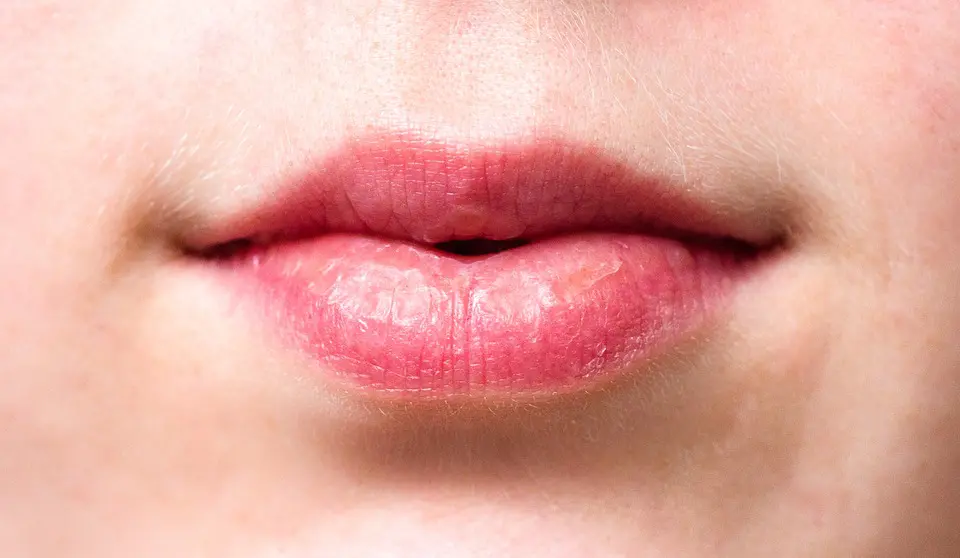 Oral Cancer Awareness Month Oral Cancer Awareness Month