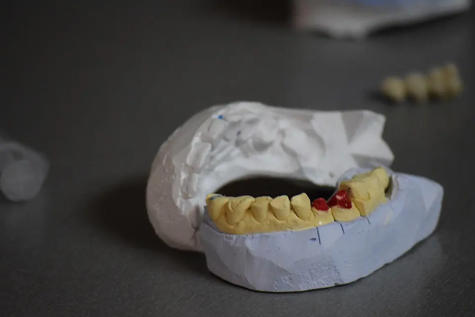 Silver vs Tooth Colored fillings Silver vs Tooth Colored fillings