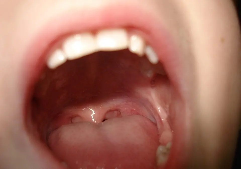 Natural Ways to Clean Your Mouth