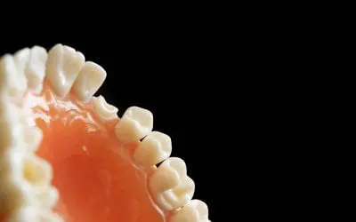 Signs of a Dead Tooth