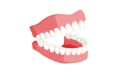 Can You Prolong your Dentures’ Lifespan?