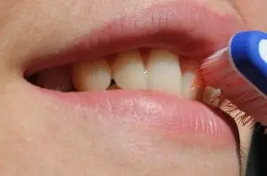 Gum Disease