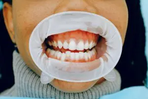 Seven Signs of Unhealthy Gums Seven Signs of Unhealthy Gums