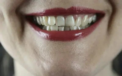 The Connection Between Teeth Grinding and Parasites