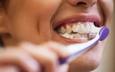 How to Clean Invisalign so Your Teeth Don’t Decline