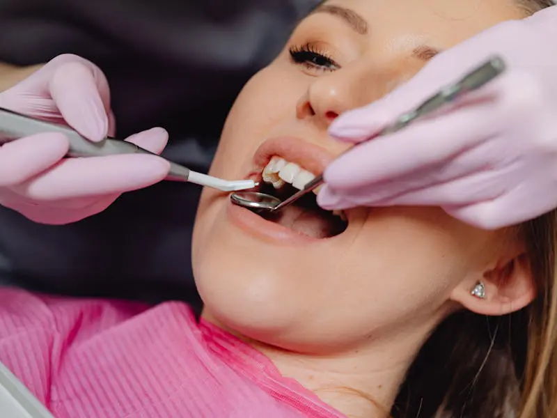 5 Tips for Preventing and Removing Dental Calculus