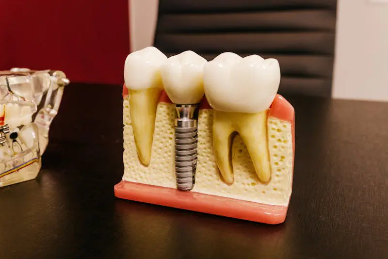 How Long Does It Take to Get a Dental Implant After a Tooth Extraction?