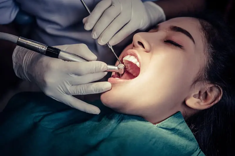 Is It Time to Replace Your Tooth Filling?