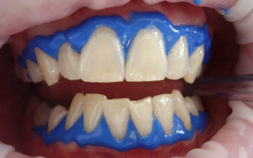 Cosmetic Dentistry for You