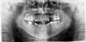 mouth x-ray