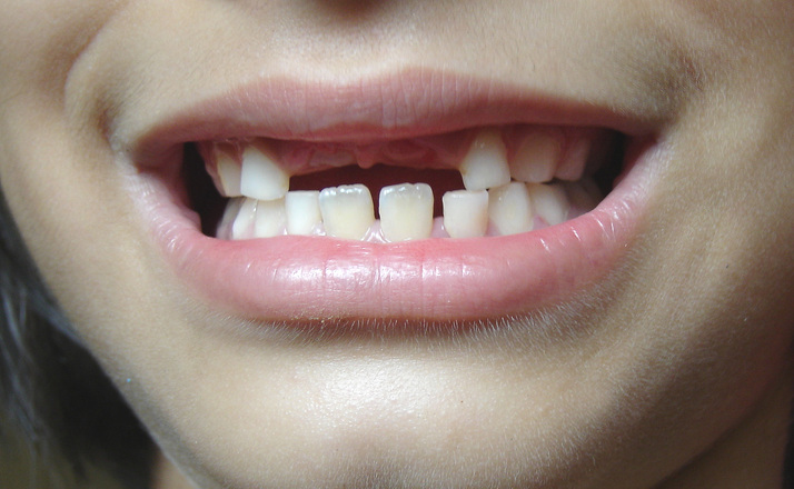 Good Oral Health Habits for Kids