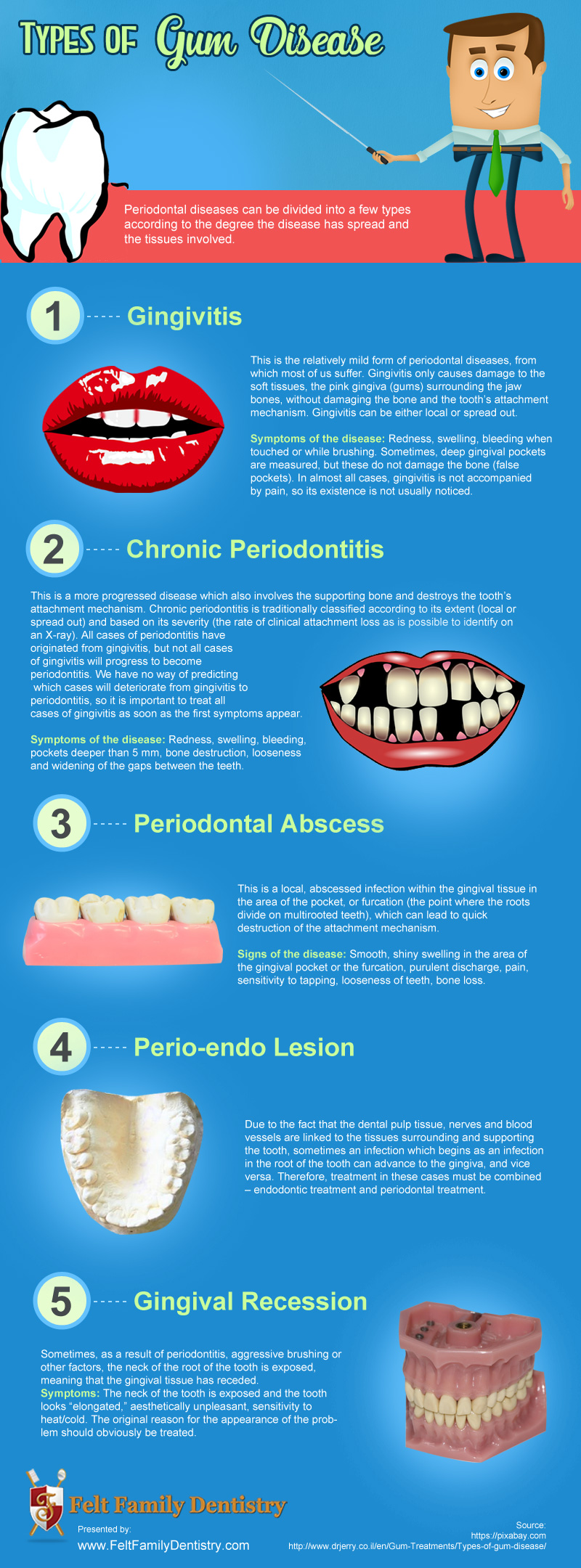 Types of Gum Disease [infographic]
