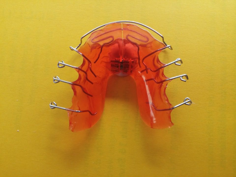 Consider Braces