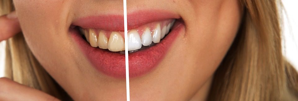 teeth yellow teeth yellow