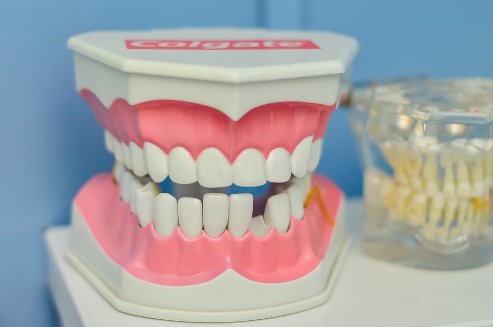 Restoring a Chipped Tooth Restoring a Chipped Tooth