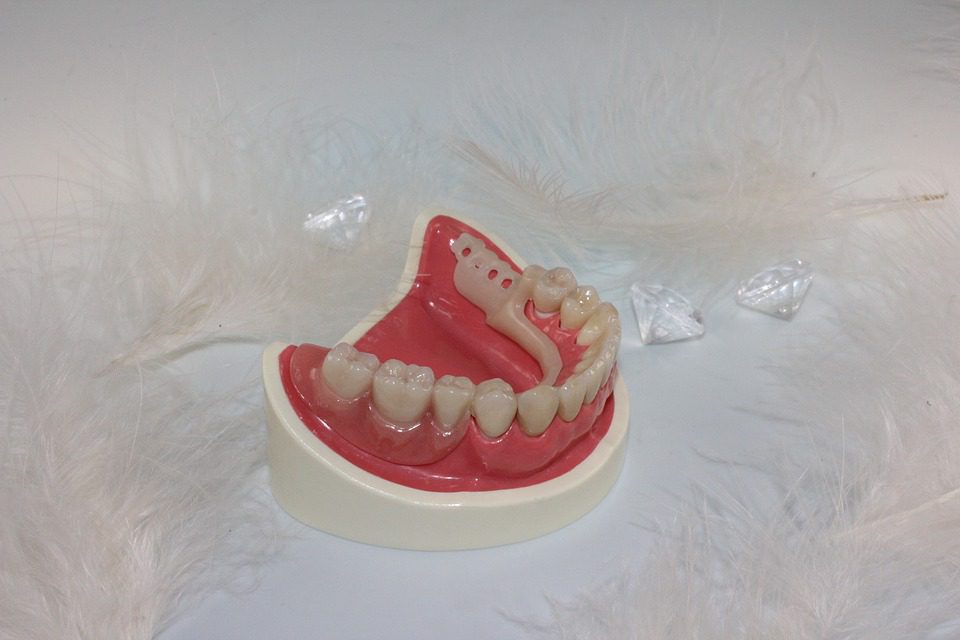 Help Removing Dentures Help Removing Dentures