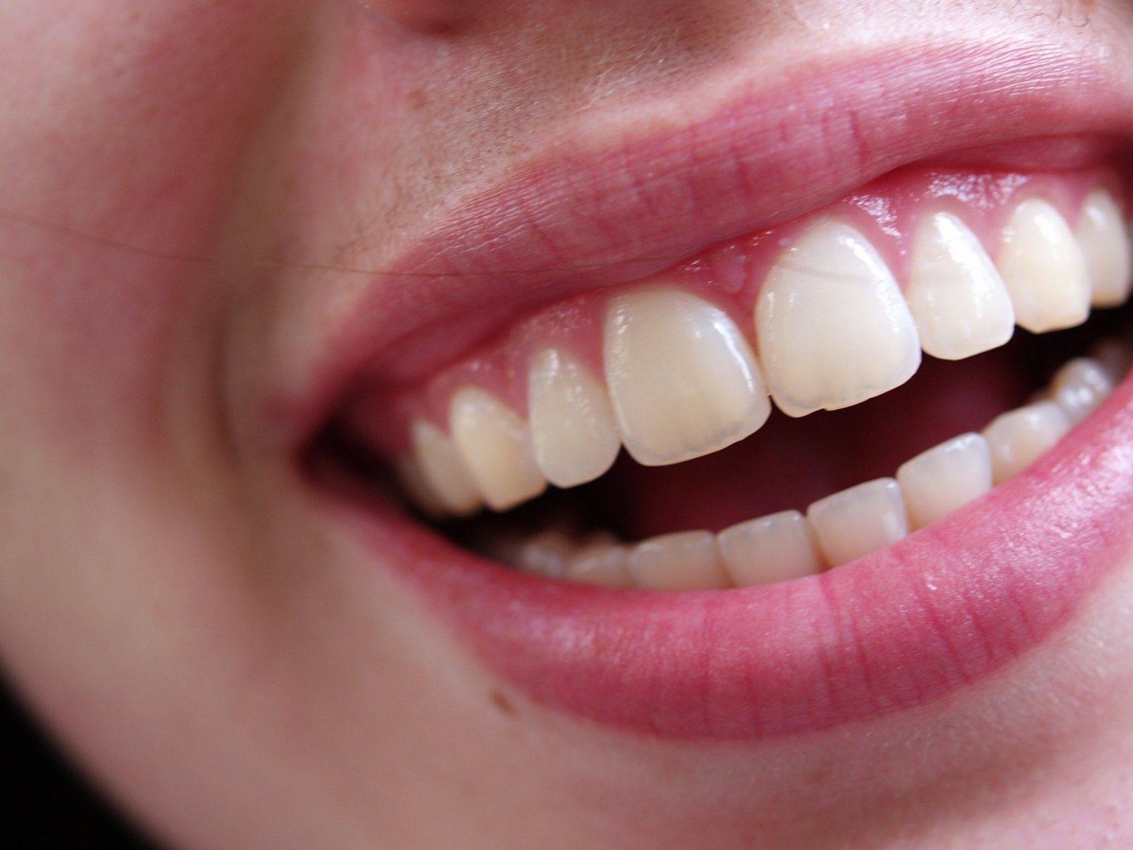 About Gum Disease About Gum Disease