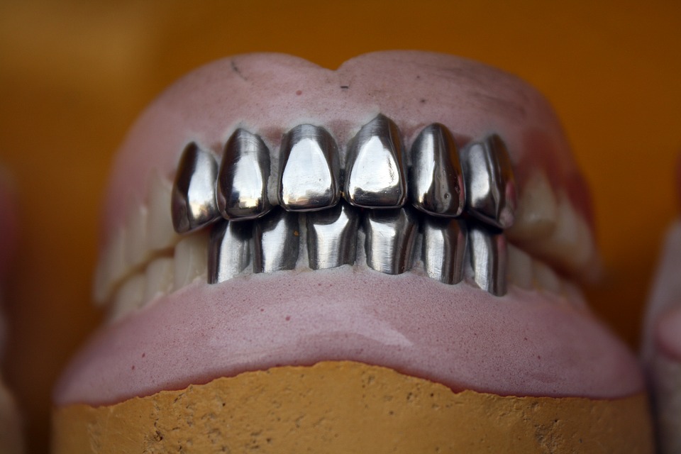 Metal or Tooth-Colored Filling