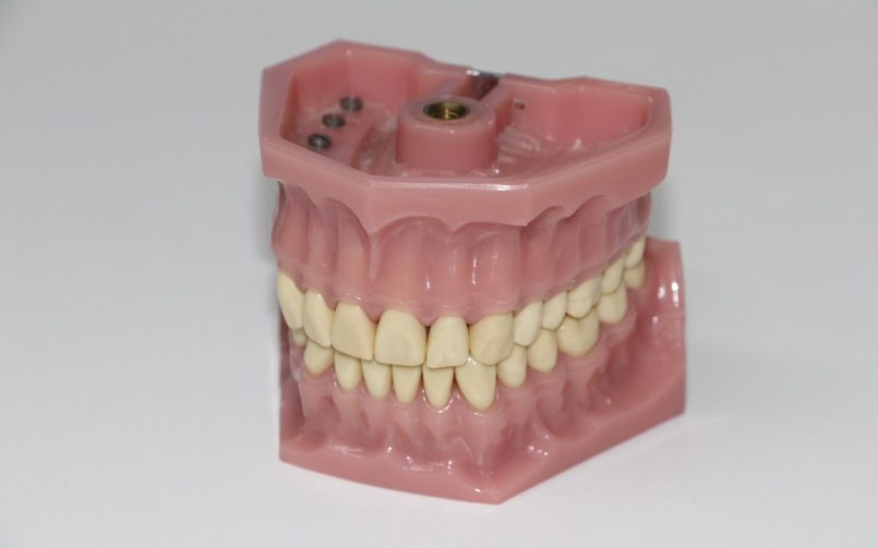 Celebrities with Dentures