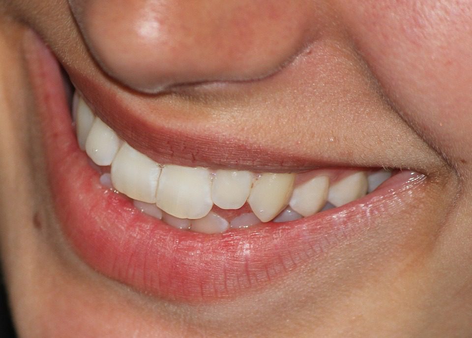 Different Ways to Enhance Your Smile Different Ways to Enhance Your Smile