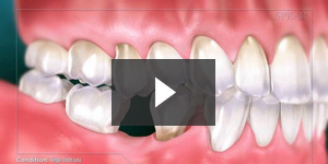 dentist videos
