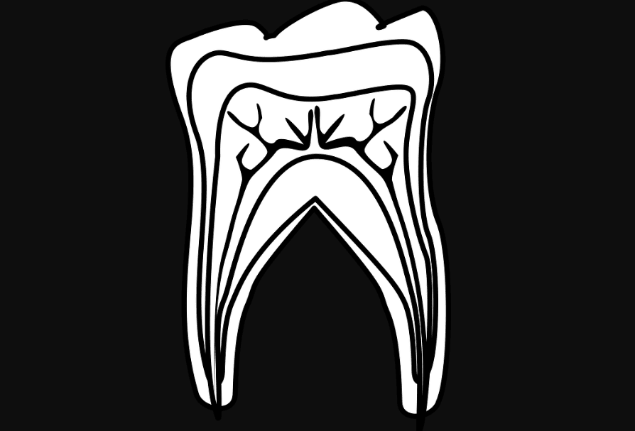 What to Know About Wisdom Tooth Extraction