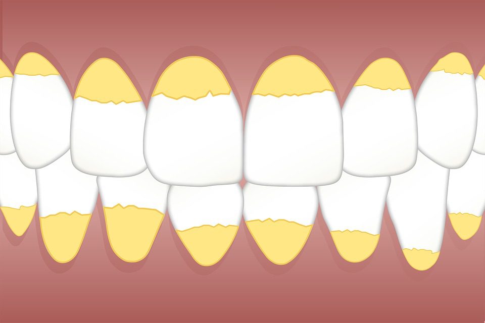 Teeth stain