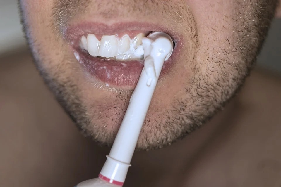 options for teeth whitening