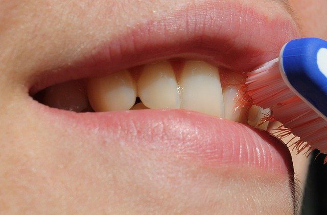 Gum Disease Gum Disease