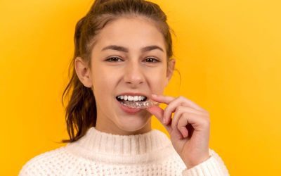 Exploring the Dangers of DIY Aligners