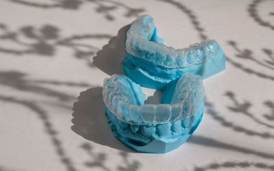 Five Questions to Ask Your Dentist About Invisalign