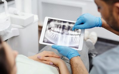 9 Cool Benefits of Digital Dental X-Rays