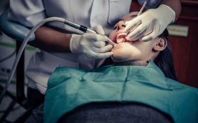 9 Questions to Ask Before Undergoing Oral Surgery