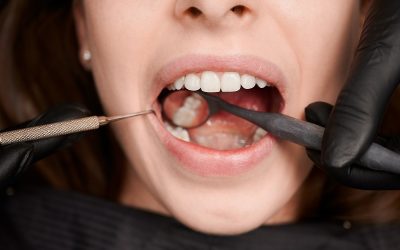 The Differences Between Cosmetic and Restorative Dentistry